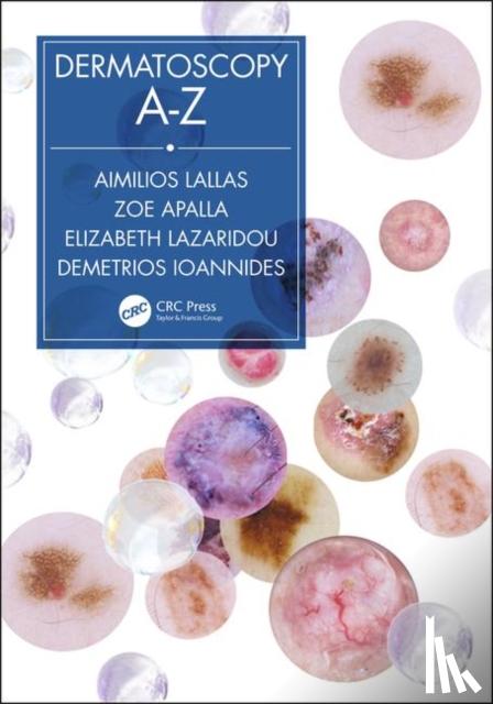 Lallas, Aimilios, Apalla, Zoe, Lazaridou, Elizabeth, Ioannides, Dimitrios - Dermatoscopy A-Z