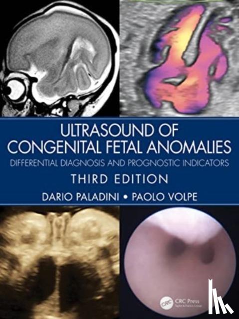 Paladini, Dario (Gaslini Children’s Hospital, Volpe, Paolo - Ultrasound of Congenital Fetal Anomalies