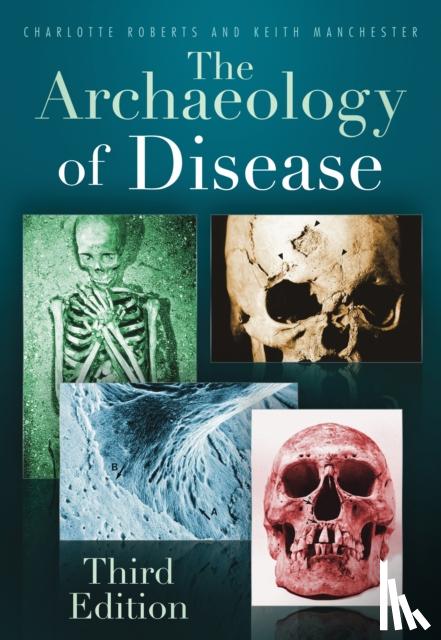 Roberts, Charlotte, Manchester, Keith - The Archaeology of Disease