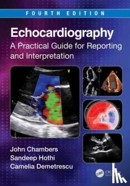 Demetrescu, Camelia (Guy’s and St Thomas’ Hospitals, Hothi, Sandeep S. (University of Birmingham, Chambers, John (Guy’s and St Thomas’ Hospitals - Echocardiography