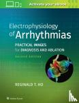 Ho, Reginald T. - Electrophysiology of Arrhythmias