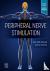 Peripheral Nerve Stimulatio...