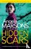 Hidden Scars - A completely...