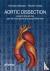 Aortic Dissection: Patients...